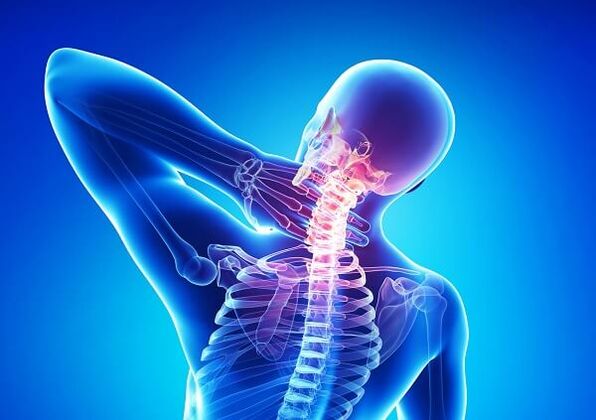 Osteochondrosis کے ساتھ گردن میں درد