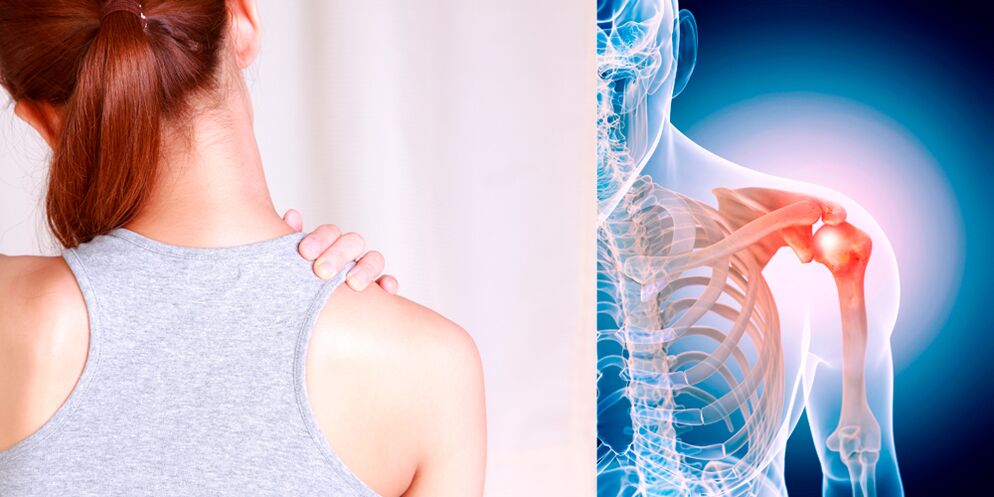 کندھے کے آسٹیوآرتھرائٹس کی ترقی آہستہ آہستہ مسلسل درد کی طرف جاتا ہے